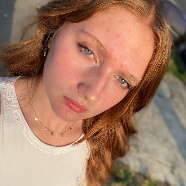 Mathilde